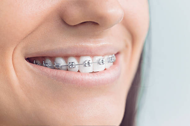 Best Tooth Extraction  in Roanoke, IL